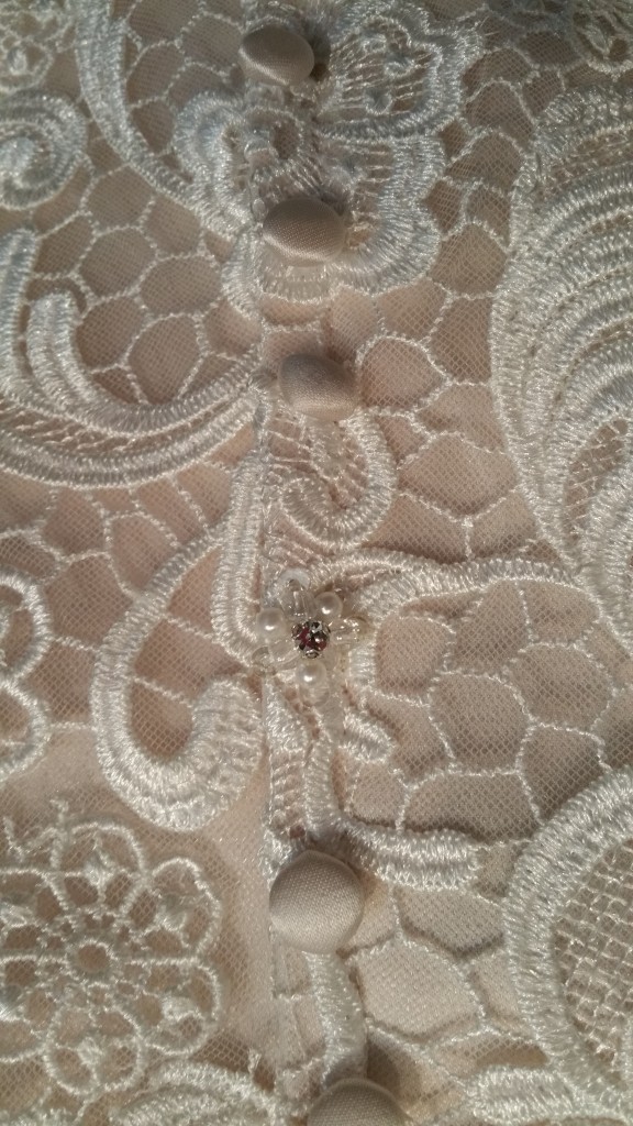 buttons on fitted lace ruffle